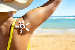 A woman standing on the beach in Boca Raton with sunscreen on her shoulder in the shape of the sun | Protect Yourself From Skin Cancer | Skin Cancer Dermatologist Boca Raton