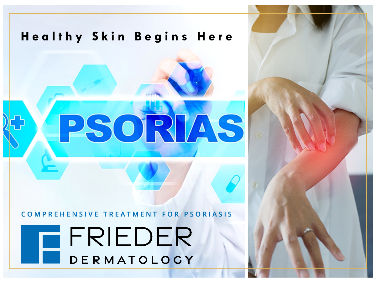 Healthy skin begins here with comprehensive treatment for psoriasis at Frider Dermatology 