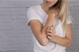 A Boca Raton woman suffering from eczema, scratching her irritated forearm