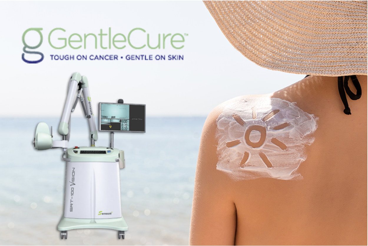 A woman with sunscreen on her back in the shape of the sun standing on a beach with the machine from GentleCure used for skin cancer treatments next to her