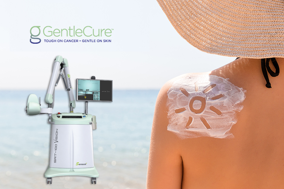 A woman with sunscreen on her back in the shape of the sun standing on a beach with the machine from GentleCure used for skin cancer treatments next to her