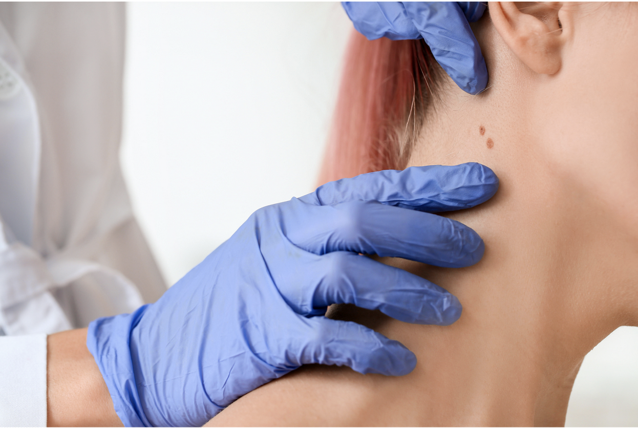 Dermatologist performing a skin cancer screening at Frieder Dermatology