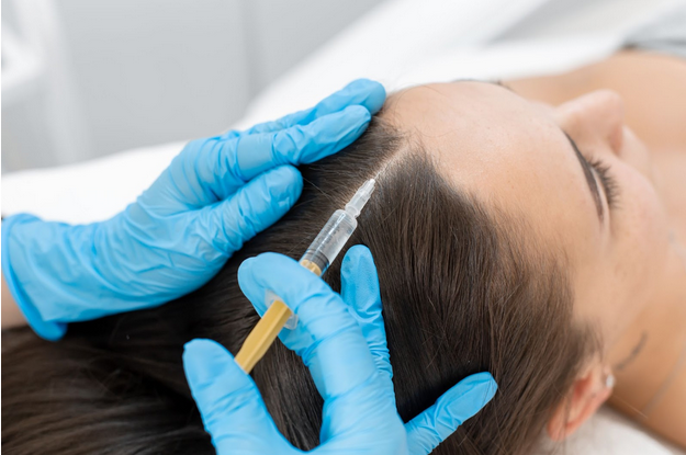 Frieder Dermatology providing PRP for Hair treatment