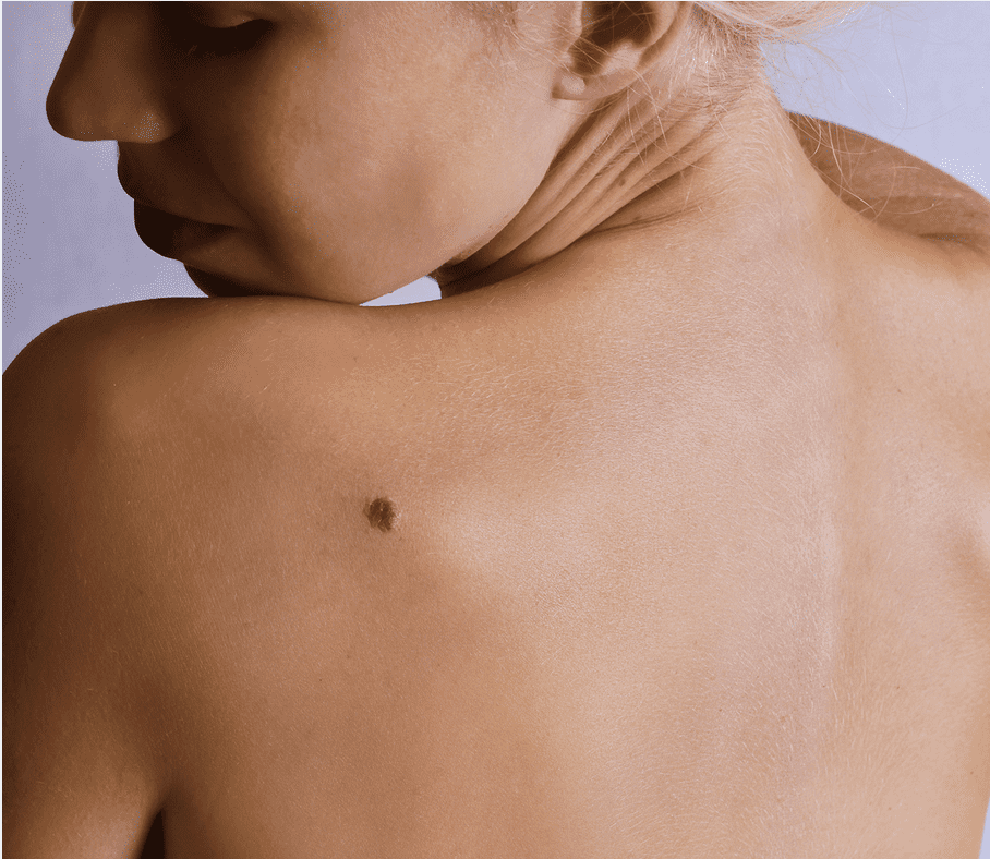 friederdermatology